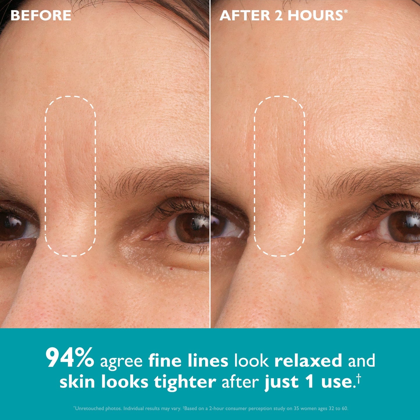 Overnight Peptide Face & Eye Tape