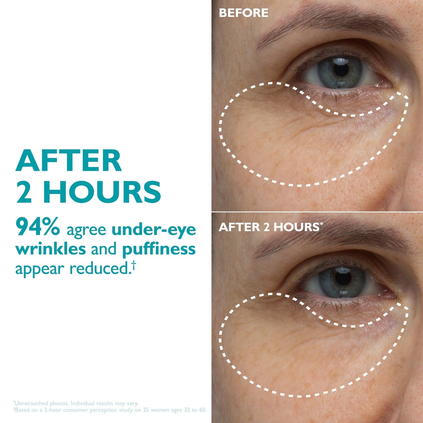 Overnight Peptide Face & Eye Tape